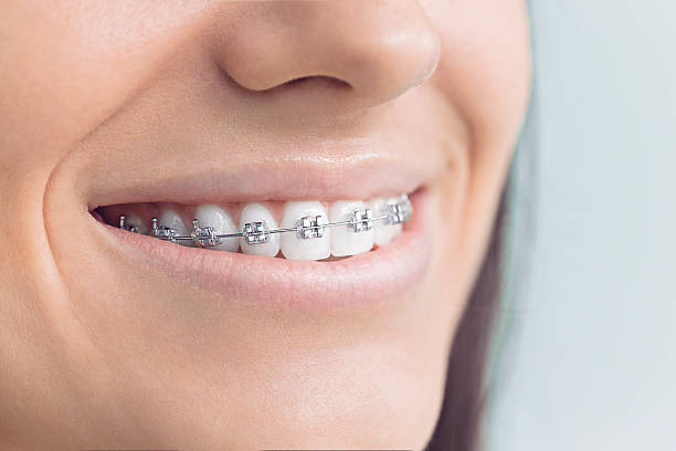 Best Full Mouth Reconstruction  in Columbus, MT
